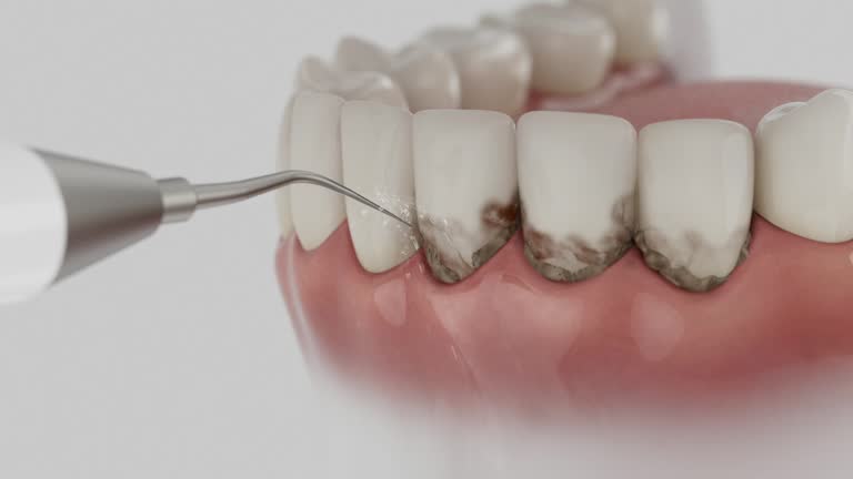 Trusted Emergency Dentist service in Harrisonville, MO - Dentist Open Now